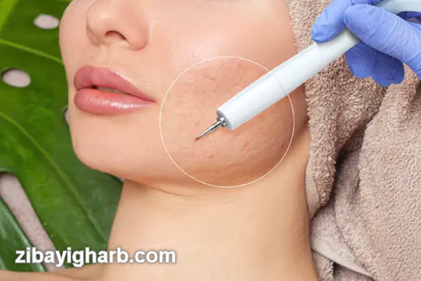 مزایای سابسیژن | مرکز زیبایی غرب