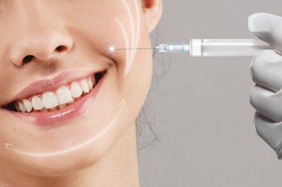تزریق فیلر خط خنده | کلینیک زیبایی غرب