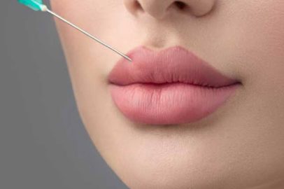تزریق ژل لب | کلینیک زیبایی غرب