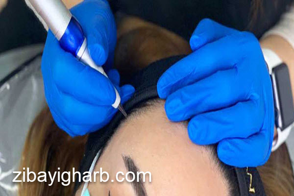 آشنایی با دستورالعمل های مراقبتی پس از اسکالپ سر | کلینیک زیبایی غرب