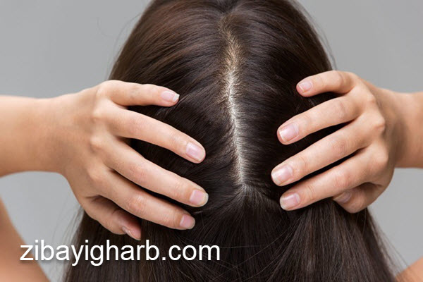 کلینیک تخصصی اسکالپ سر در صادقیه | کلینیک زیبایی غرب