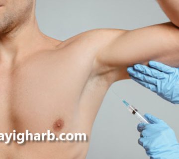 بهترین دکتر بوتاکس زیر بغل در صادقیه