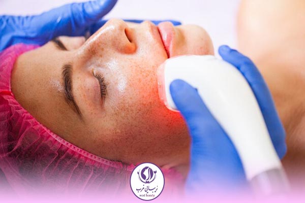 قیمت انواع لیزر کک و مک