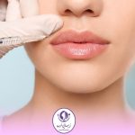 قیمت و هزینه تزریق ژل لب در تهران