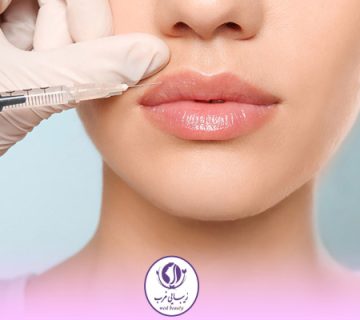 قیمت و هزینه تزریق ژل لب در تهران