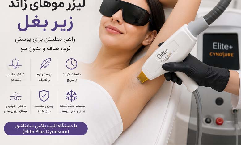 لیزر موهای زائد زیر بغل با دستگاه لیزر الیت پلاس سایناشور