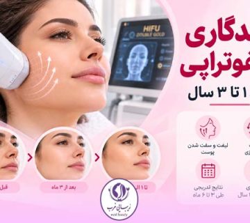 ماندگاری هایفوتراپی چقدر است