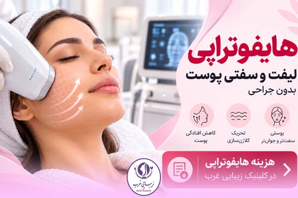 hifu cost هزینه هایفوتراپی چقدر است