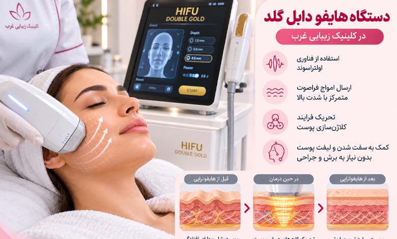 هایفوتراپی در کلینیک زیبایی غرب با دستگاه دابل گلد